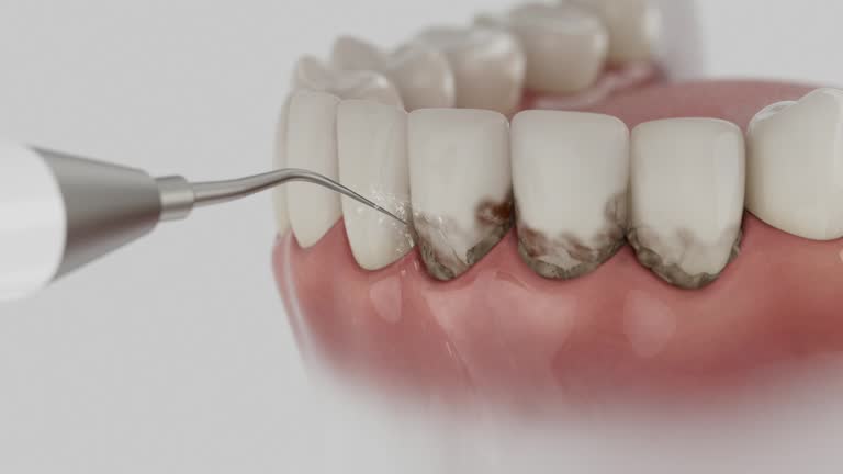 Reliable Dental contractor in Monroeville, OH by Smile Center Dentistry